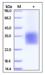 Cynomolgus CD3 delta, His Tag on SDS-PAGE under reducing (R) condition. The gel was stained overnight with Coomassie Blue. The purity of the protein is greater than 90%.